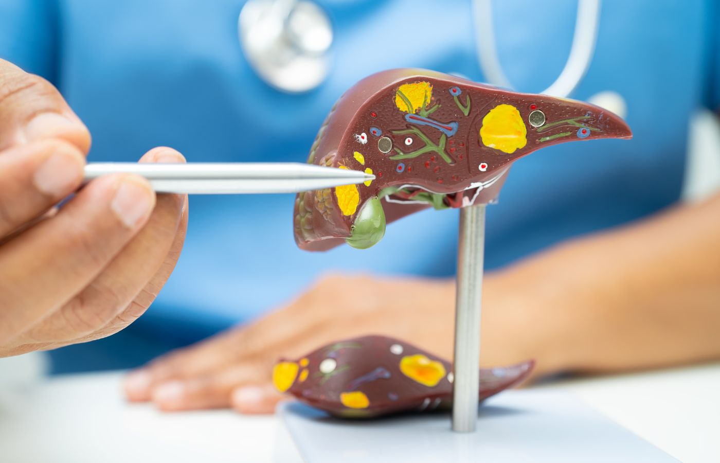Manage Cirrhosis